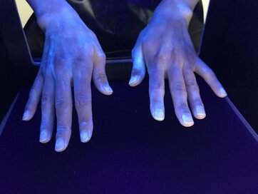 ノロウイルス予防法！家の中でトイレよりも汚い場所とは？