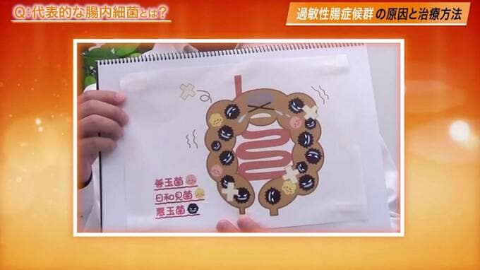 腸のイラストを持つ様子