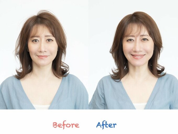 ビフォーアフター