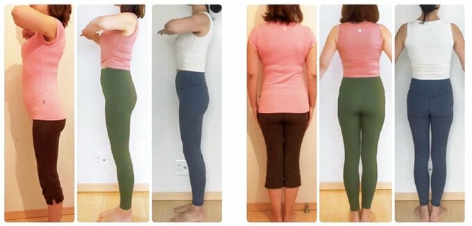 Nさんビフォーアフター