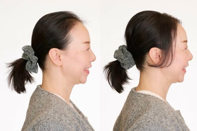 横向きのビフォーアフター