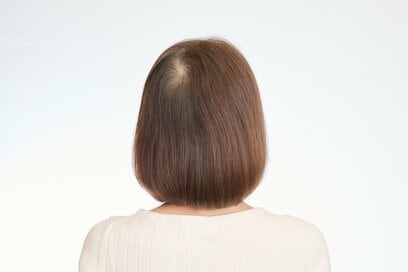 50代60代「つむじ周りの髪が薄い」ときの対処法。ドライヤーひとつでふんわり解消