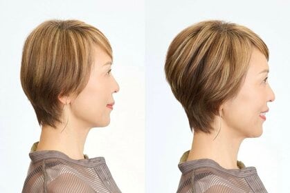 大人のヘア問題白黒つけます