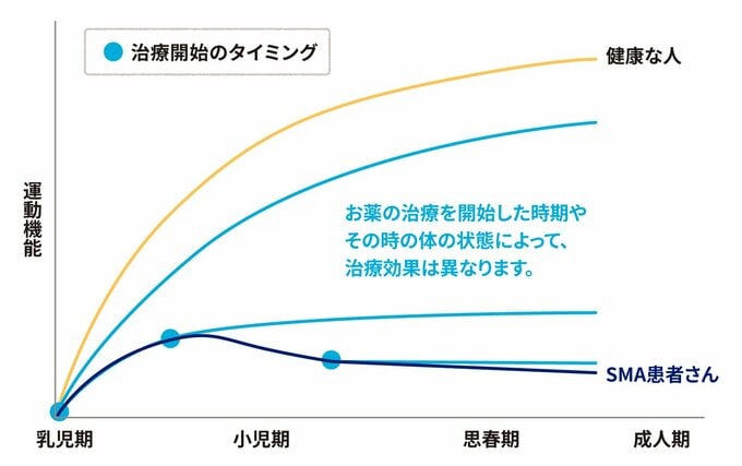 SMA治療開始のタイミング