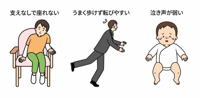 SMAそのものの症状