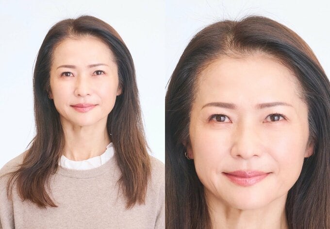 生えグセのある女性