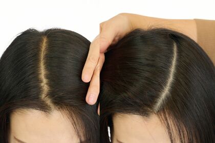 大人のヘア問題白黒つけます