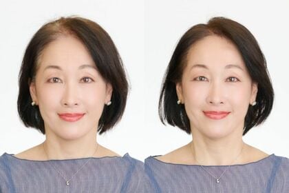 大人のヘア問題白黒つけます