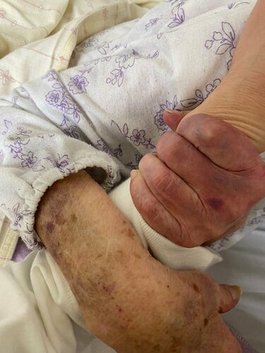 孫の腕を握りしめる祖母