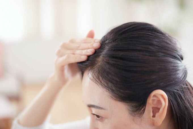髪の毛の生え際を気にする女性