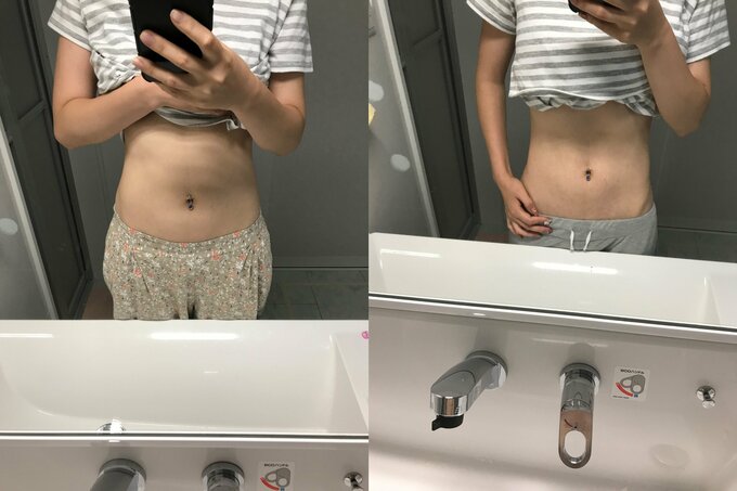 ビフォーアフター