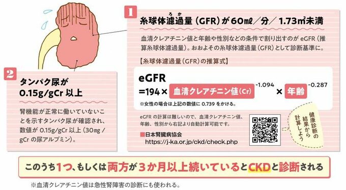 CKD説明イラスト