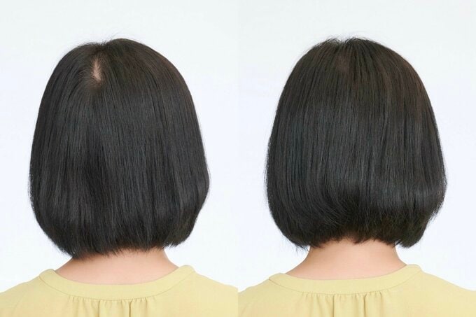 後頭部のビフォーアフター