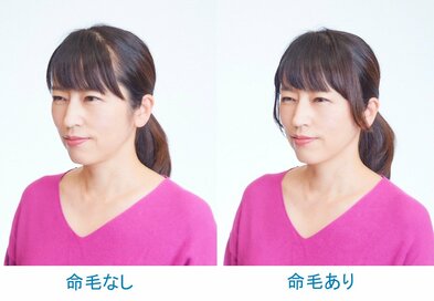 命毛（いのげ）って知ってる？あるだけで小顔効果絶大＆薄毛隠しにも