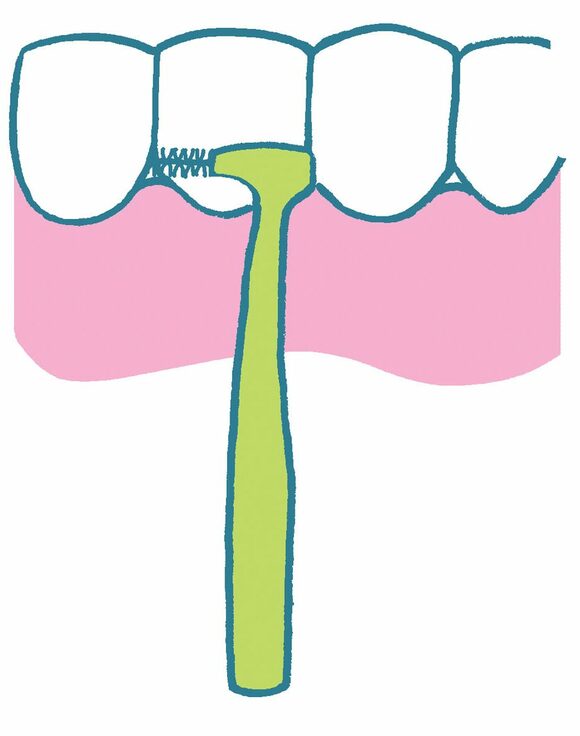 イラスト歯と歯間ブラシ