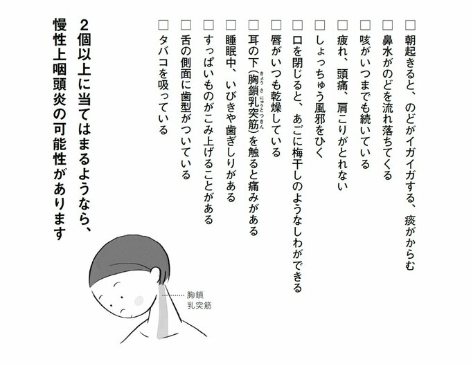 チェックリスト