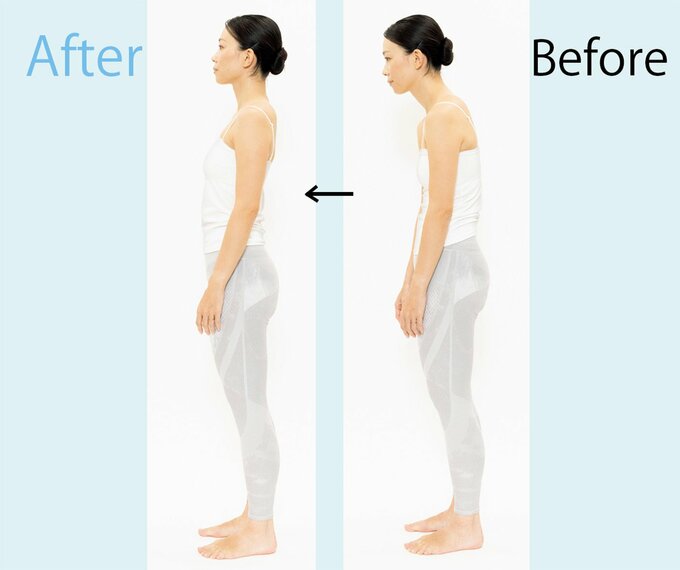 女性の姿勢のビフォーアフター