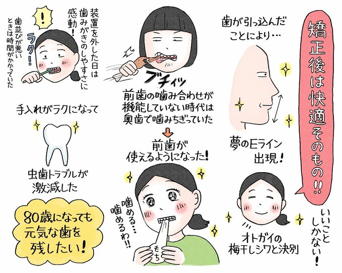 歯列矯正で得られた効果