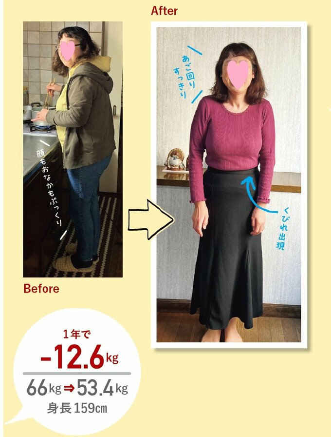 美雪さんのビフォーアフター