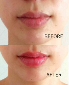「老け唇」を回避！ティントリップが優秀すぎる