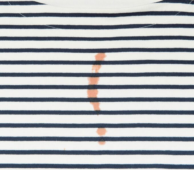 服についた血液のシミ