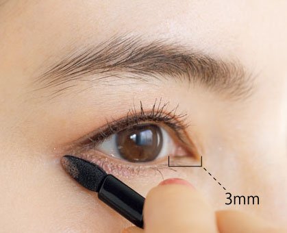 目の下3mm
