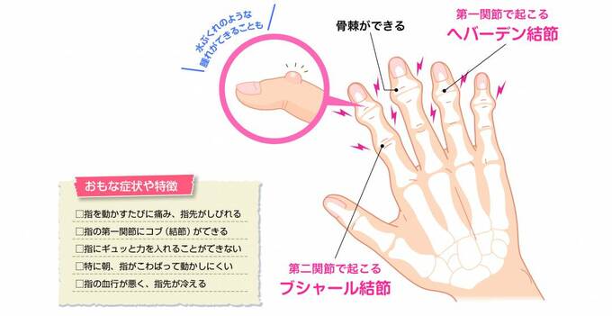 手指の痛みは加齢だけが原因じゃない！悪化予防マッサージ | ESSEonline（エッセ オンライン）