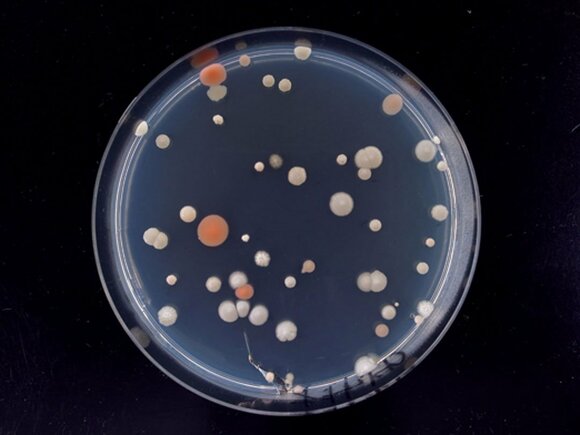 キッチンシンクカビ