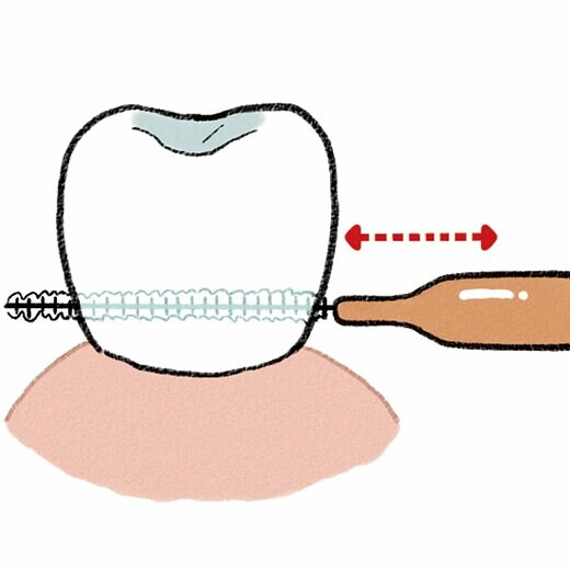歯間ブラシを前後に動かす様子