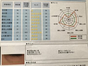 シミ、シワ、毛穴を測定して対策も！デパートの無料肌診断サービスが使える