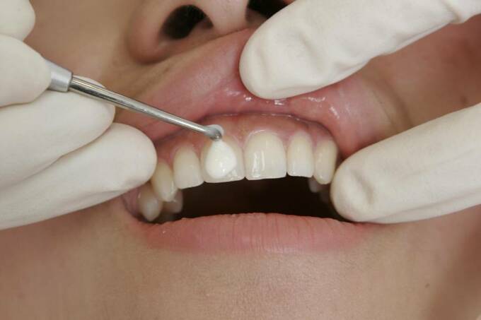 ホワイトコート施術中