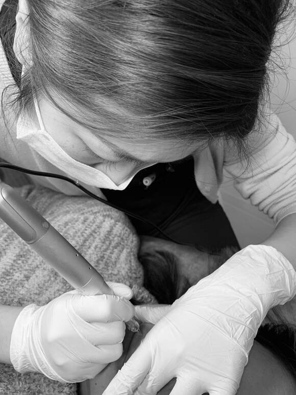 アートメイク施術中の様子