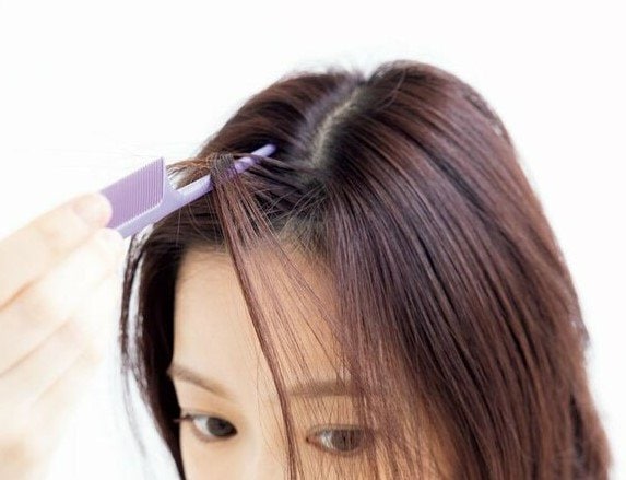 女性頭頂