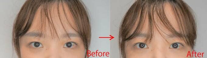 目頭BeforeAfter