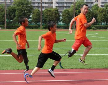走ることで希望を増やしたい！スポーツ義足に込められた想いとは