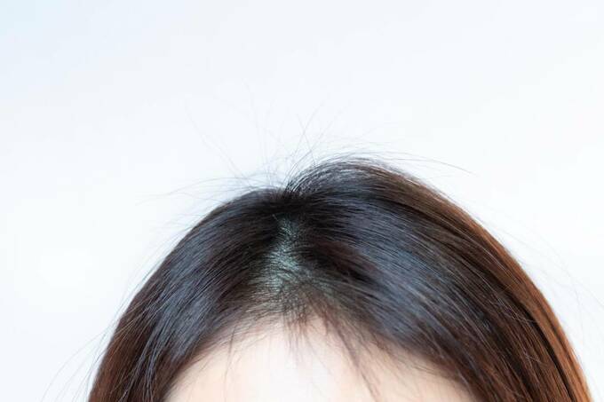 アホ毛