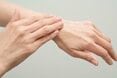 意外と知らない「ワセリン」の使い方。効果的な塗り方＆活用術を医師が解説