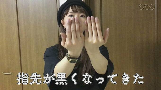 指先の黒ずみも気になるように