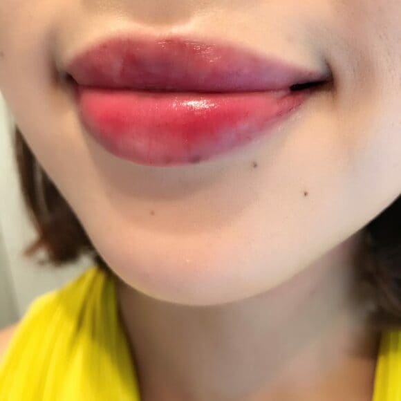 私はパールタイプの方が好きでした。