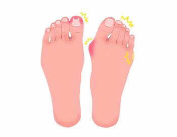 ぺたんこ靴でも外反母趾に。予防・改善に30秒ストレッチ