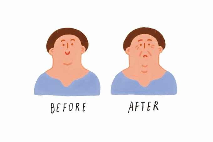 顔のシワやたるみを表したビフォーアフターのイラスト