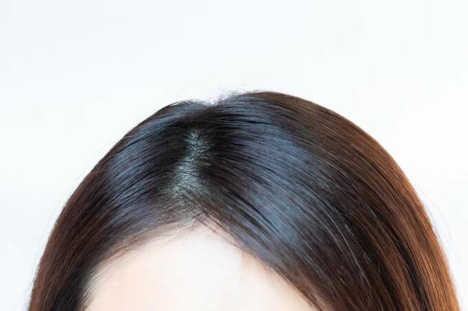 アホ毛がなくなった髪