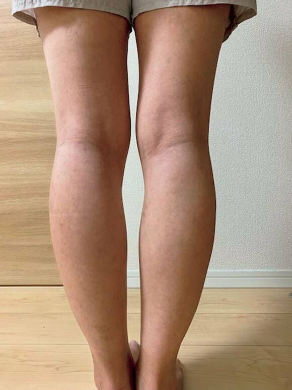 足後ろからAFTER