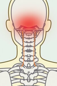 頭痛に効く！体操