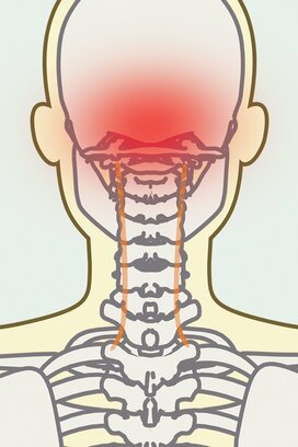 利き手を使いすぎると頭痛に!?痛みに効く「人体力学」の10秒刺激体操