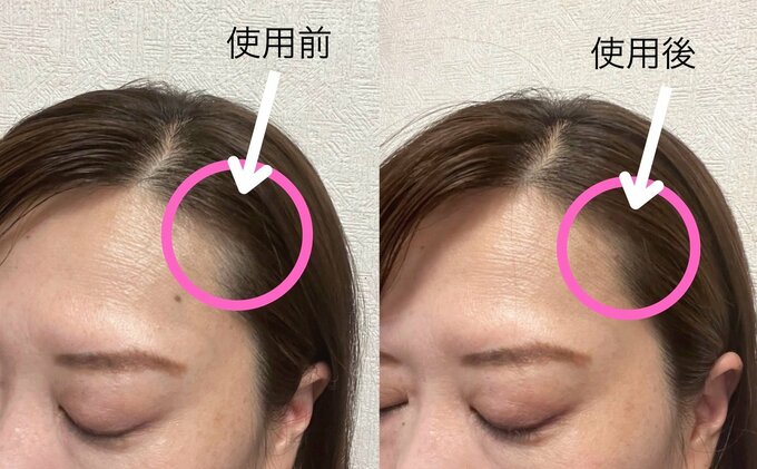 スリコ ヘアパウダー ブラウン ビフォアフ