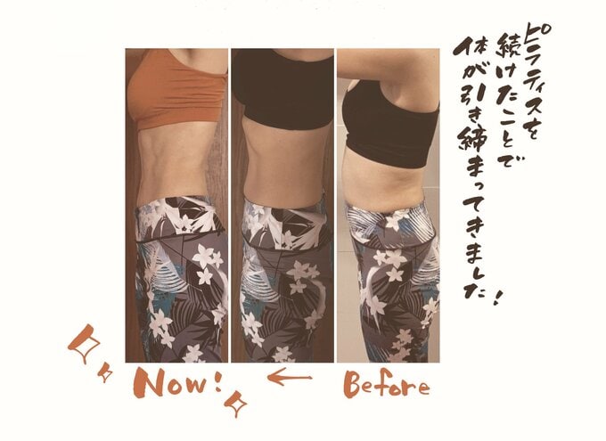 お腹のビフォーアフター