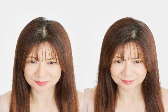 白髪ビフォーアフター