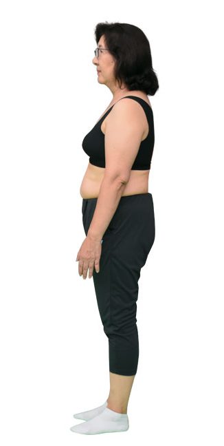 山田道子さんBEFORE