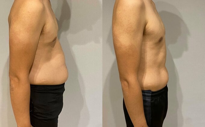 3か月で9kgやせたしょーさん(夫)